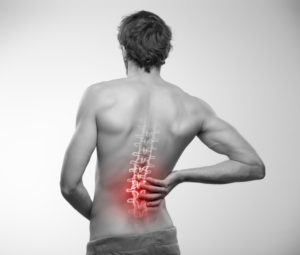 Causes of Lumbar Radiculopathy