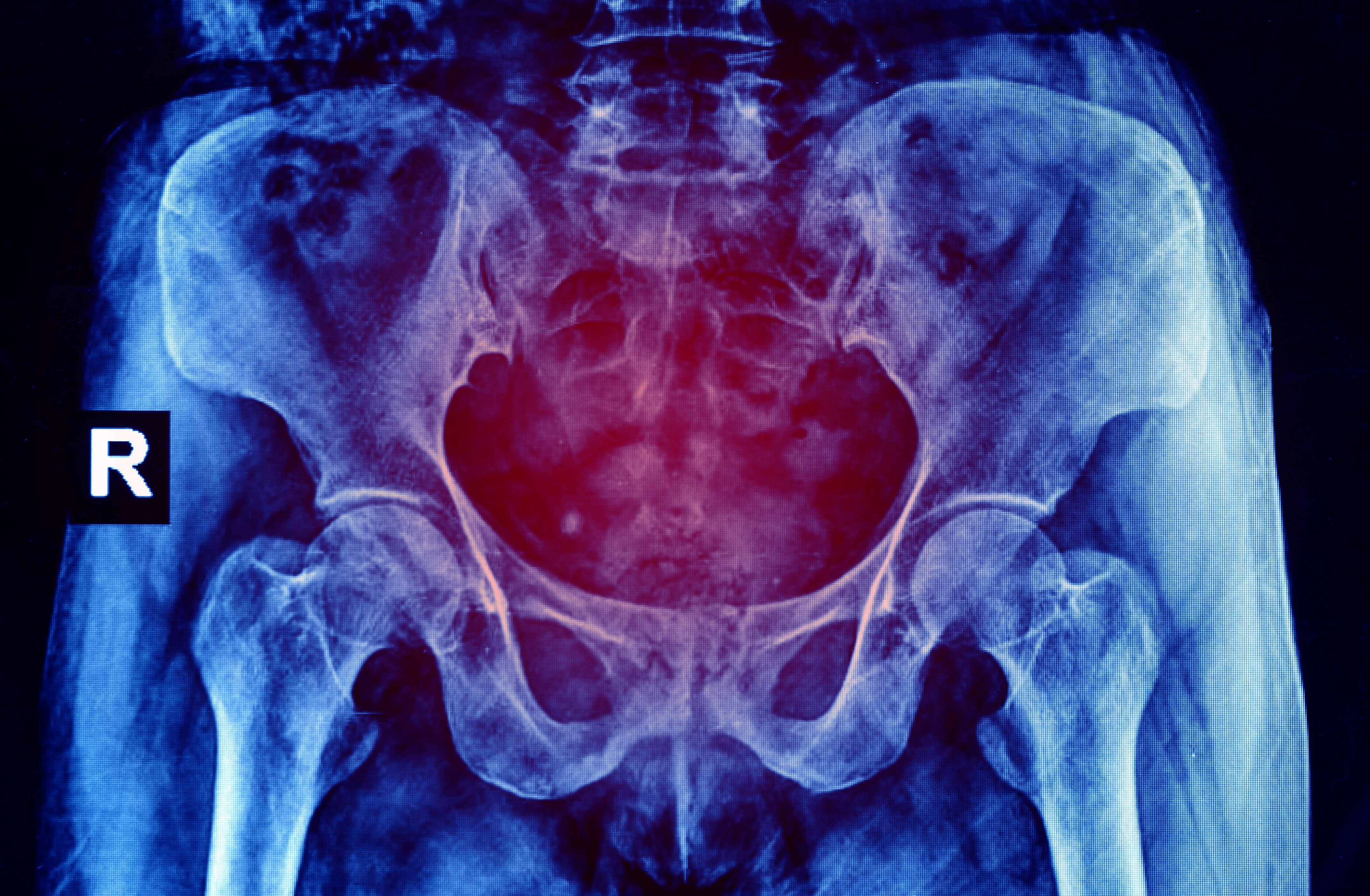 Pelvic Pain Texas Pain Physicians