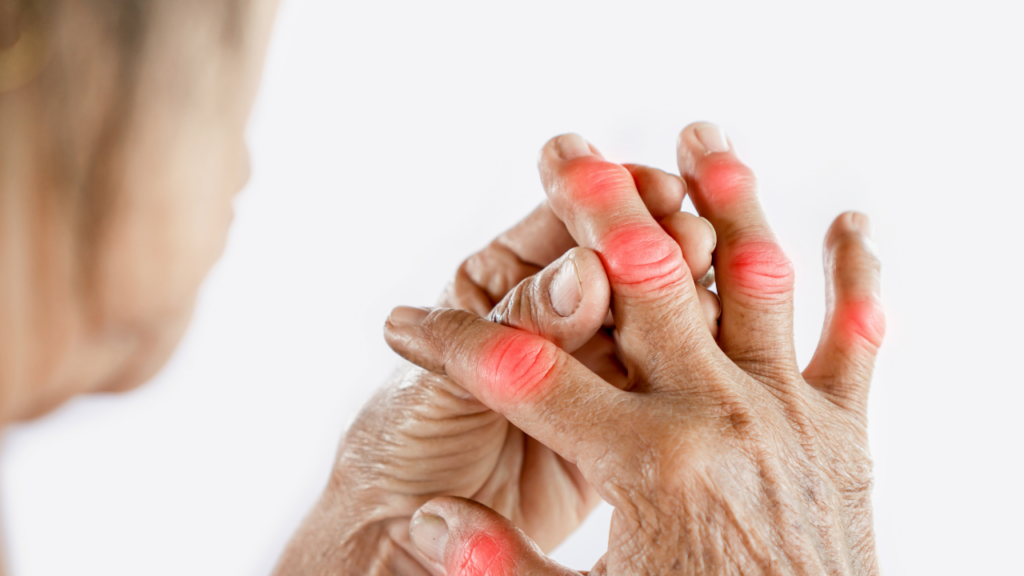 7 Hand and Finger Exercises for Arthritis Pain
