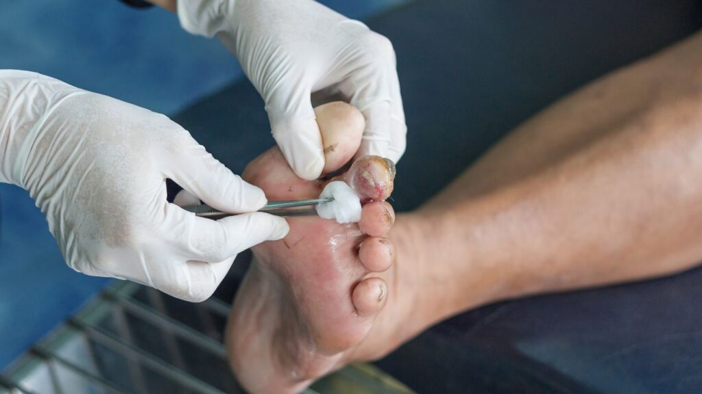 Can you have neuropathy without diabetes (2)